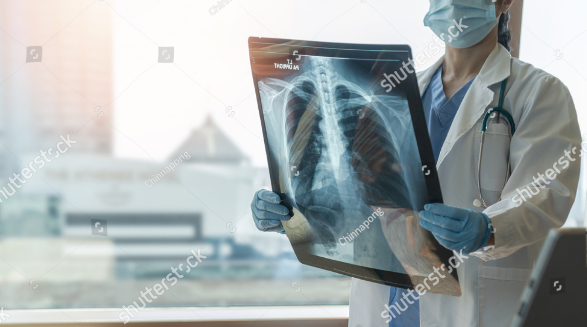 Evaluación de Hipertensión Pulmonar y Fibrosis Quísticar